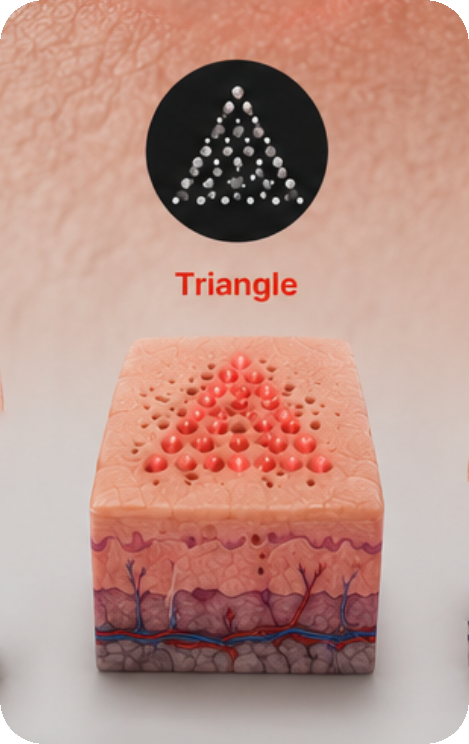 Forma de scanner Triangle