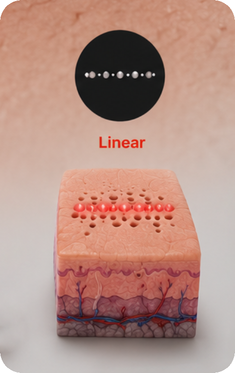 Forma de scanner Linear